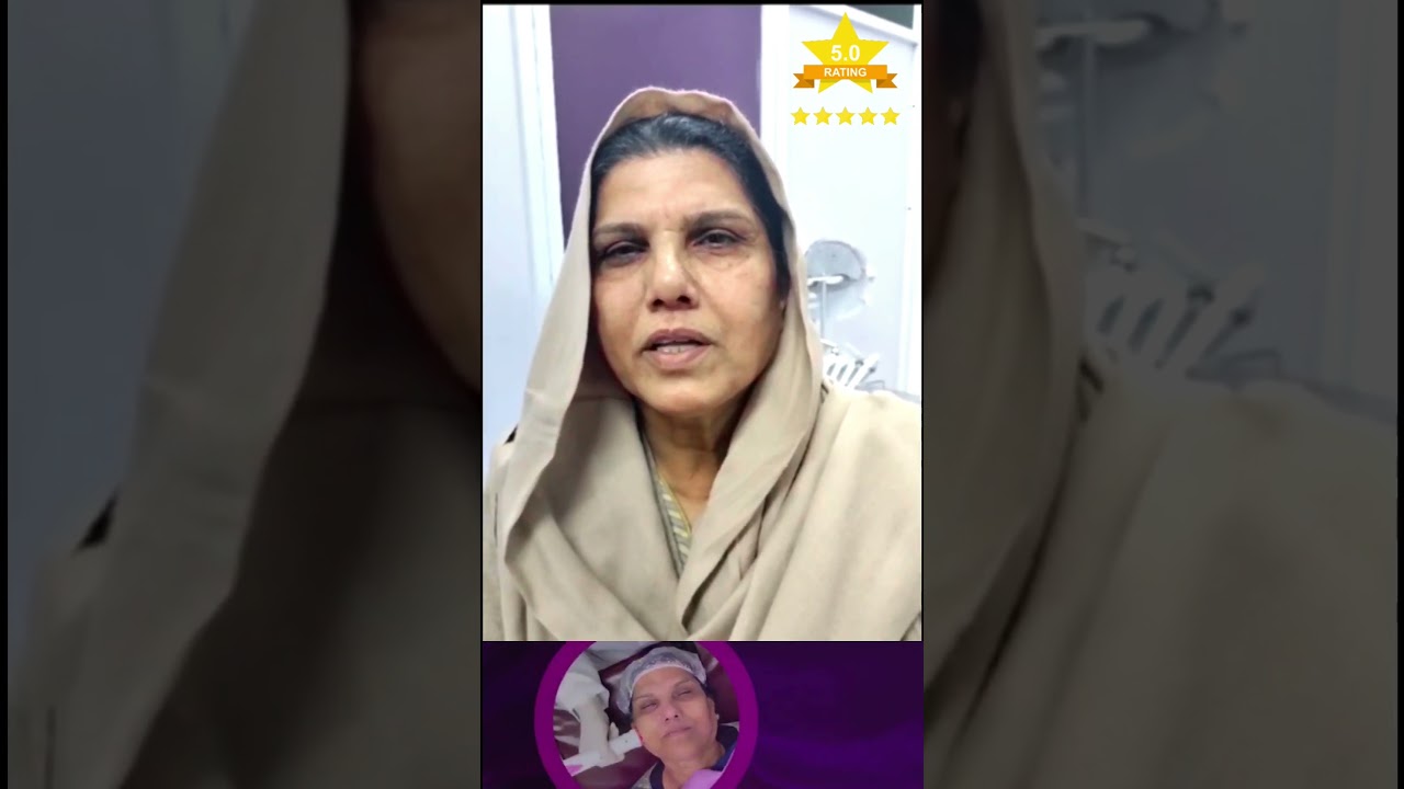 RF Face Lifting Treatment|