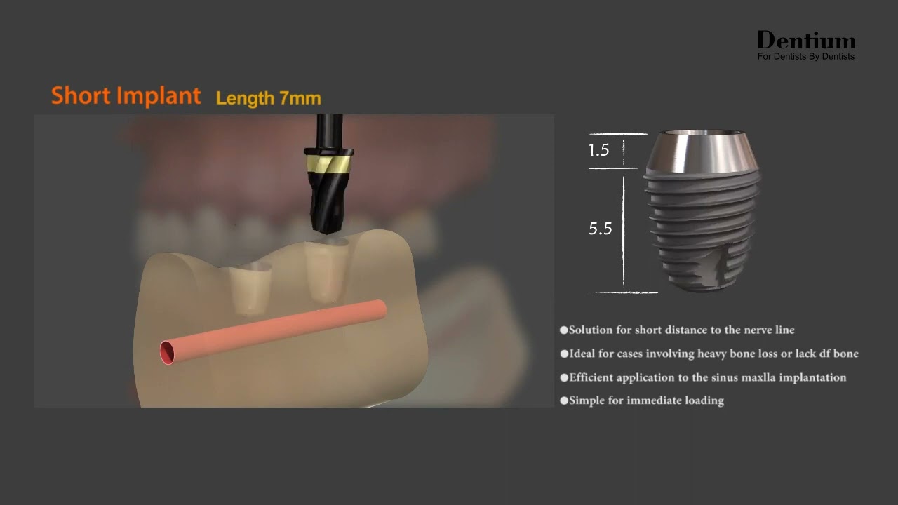 Cliché mais aposta esfogíteado dilúvio tem assunto eróticos apetitivo afobado de ar: dano de Cercar$ 2,8 milhões
