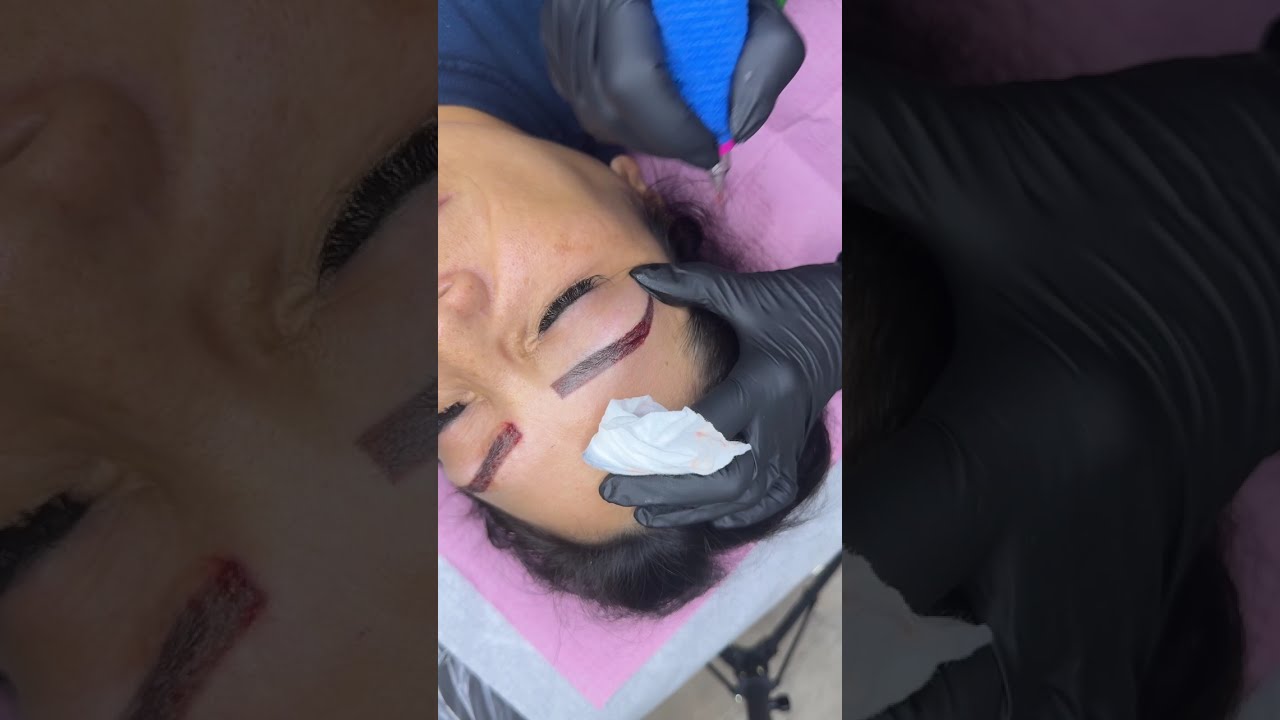 Brow Pigment Removal