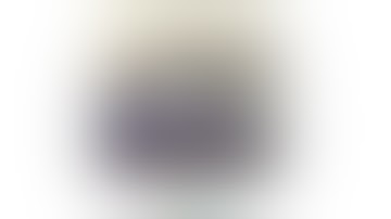 Robotic-assisted thoracoscopic right lower lobe basilar posterior and lateral (S9+10) segmentectomy