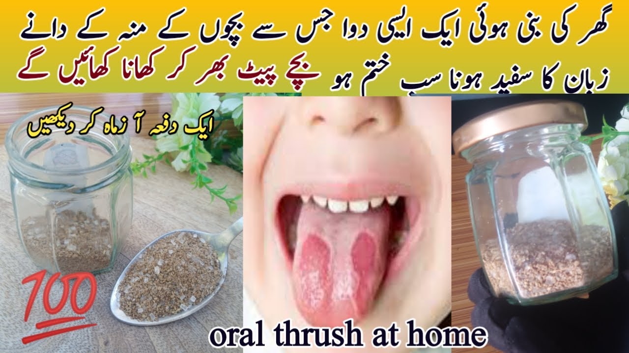 moun-k-dany-k-liye-home-made-remedy-mouth-thrush-baby-home-made