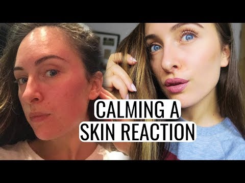 HOW TO CALM A SKIN REACTION - Tiny Bumps, Redness, Cystic Acne and more!