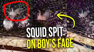 Squid Spit on a Boy’s Face While Saying He Was Spitting on Him