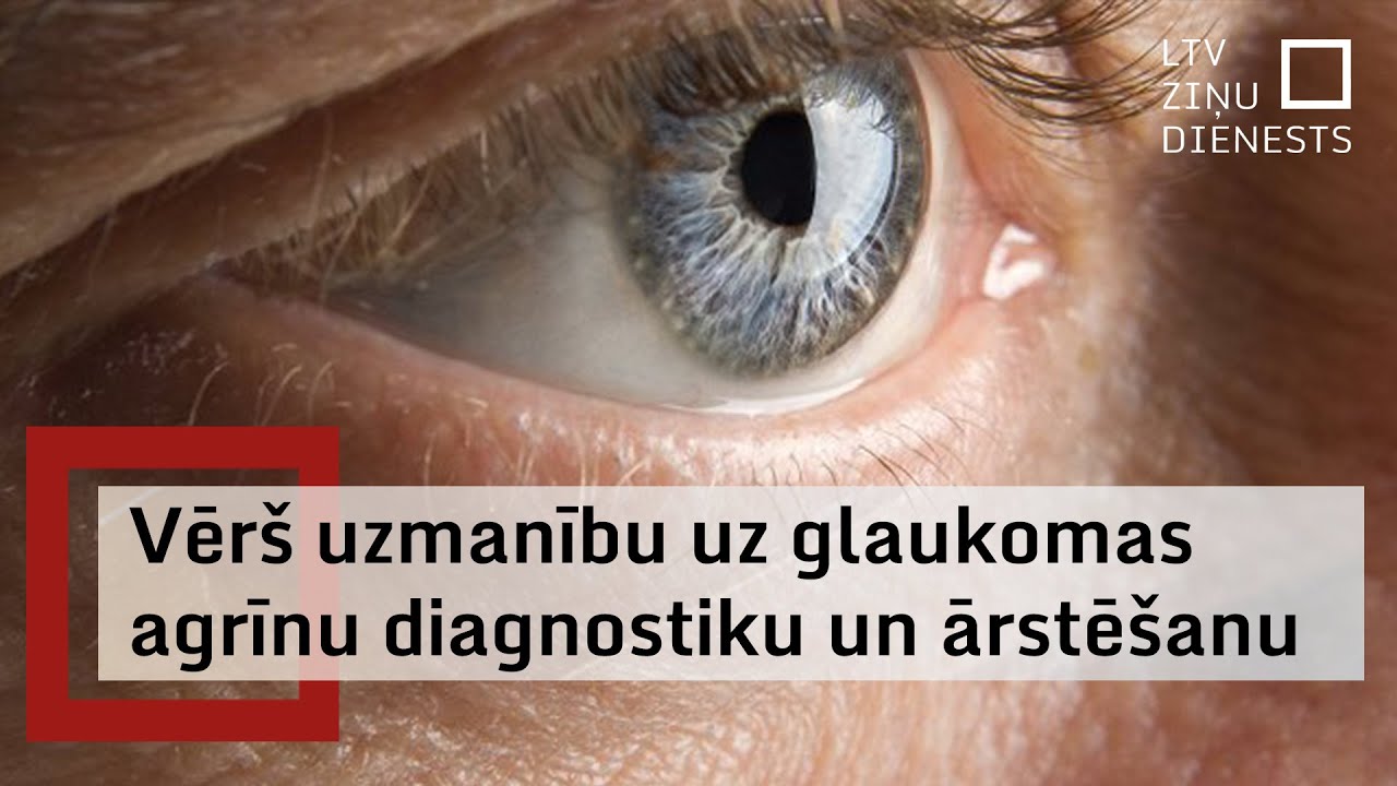 Aicina rūpēties par acu veselību un regulāri veikt pārbaudes pie acu ārsta