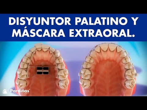 Dentpi El Salvador on X: Máscara facial para ortodoncia