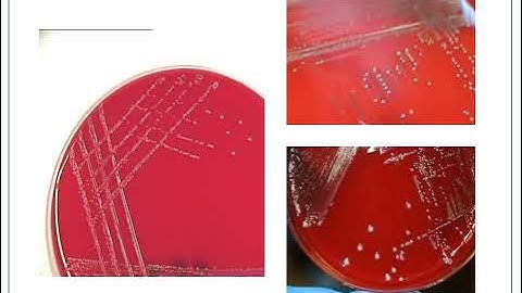 Unit 9, Enterococcus and gamma streps Narrated