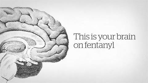How fentanyl kills: A CBC News explainer