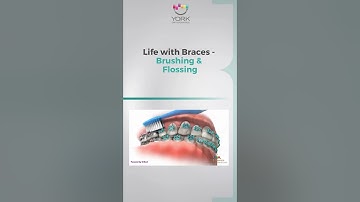 Life with Braces   Brushing &  Flossing
