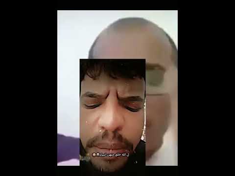 بم في مصطفى الكصه