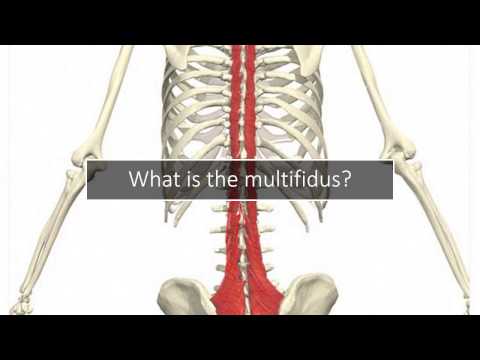 Multifidus Back Pain: Why Your Doctor Never Discussed It