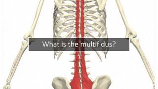 Breaking Down Multifidus Muscle Pain: Causes and Symptoms
