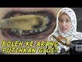 Boleh Ke Arang Putihkan Gigi?