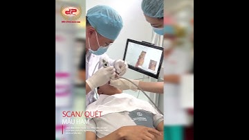 Lấy dấu răng bằng máy quét 3 chiều, Nha khoa Quốc Bình