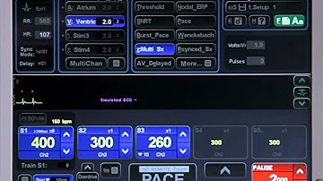 4F - Pacing Protocols - MultiSx 2: StopOnTachy