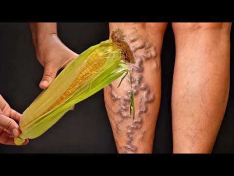 Eine Pflanze, die alles heilt❗️Krampfadern, Arthritis, Schwellungen, Rheuma, Nieren und Leber 🌽