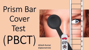 Prism Bar Cover Test | Prism Cover Test | PBCT | PCT | Squint | Strabismus