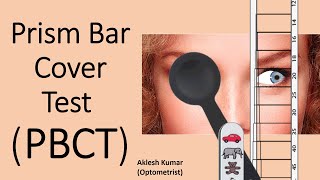 Prism Bar Cover Test | Prism Cover Test | PBCT | PCT | Squint | Strabismus
