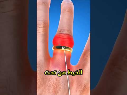 أسهل طريقة عشان تشيل خاتم اذا علق في يدك معلومات   98 تجربة