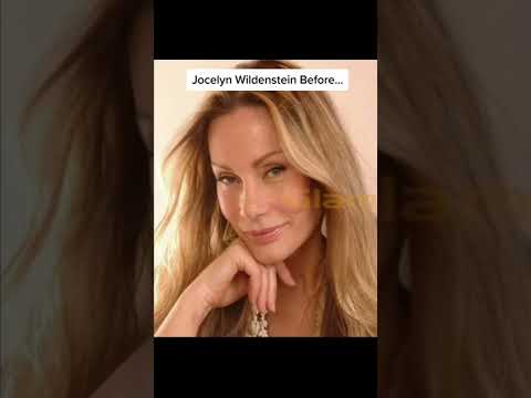 Celebrities Before And