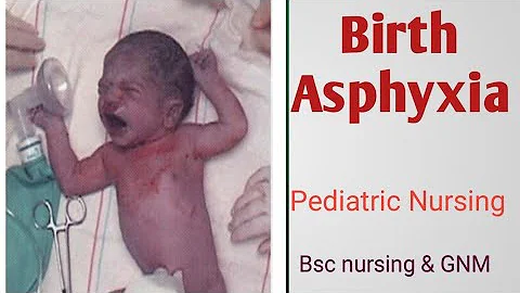 Birth asphyxia or Asphyxia neonatorum
