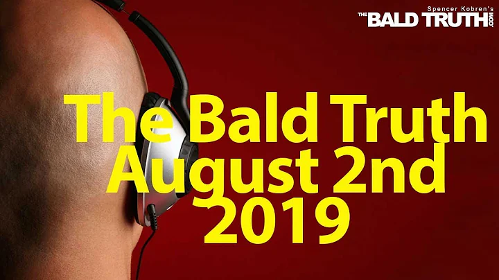The Bald Truth Friday August 2nd, 2019 Hair loss, Hair Transplants, FUE