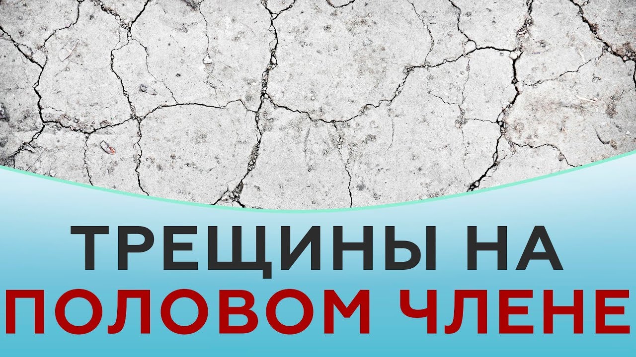 Трещины на половом члене - YouTube