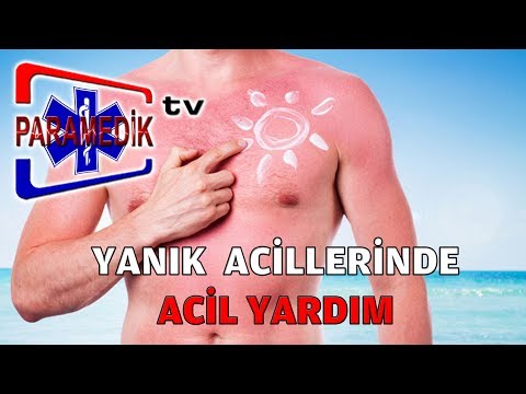 YANIK'larda Acil Yardım Nasıl Yapılmalıdır ?