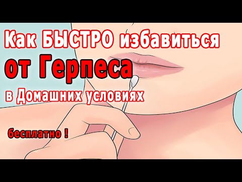 ✔ Как Вылечить Герпес на Губах в Домашних Условиях Быстро &#55357;&#56397; Как Избавиться от Герпеса НАВСЕГДА