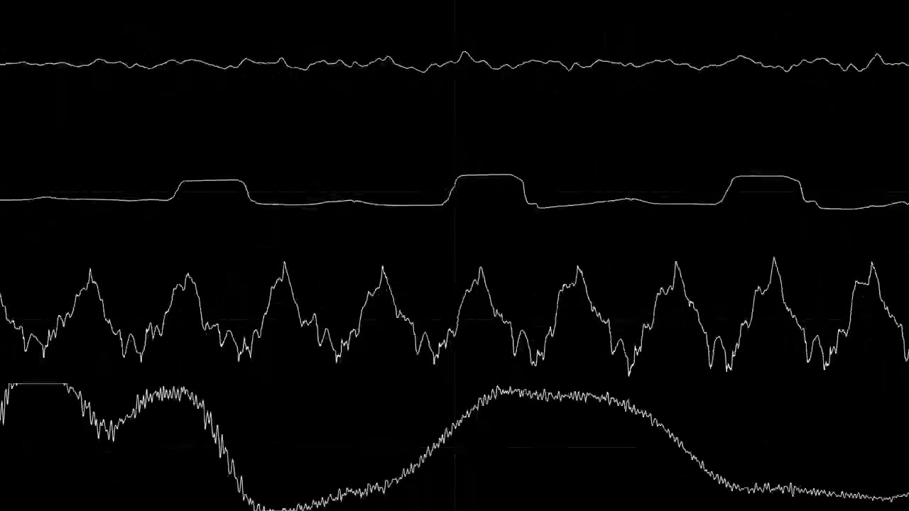 Tim Follin - Agent X (SquareWave Remix)