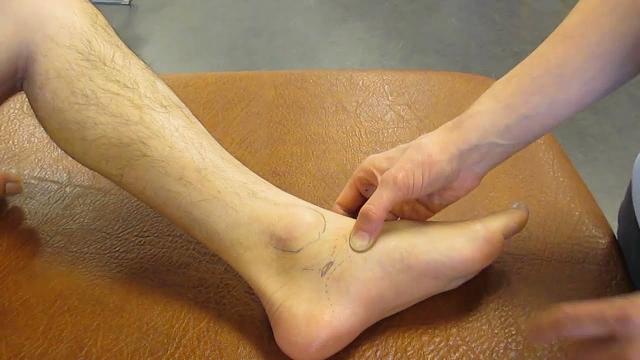 Navicular tuberosity ankle palpation youtube