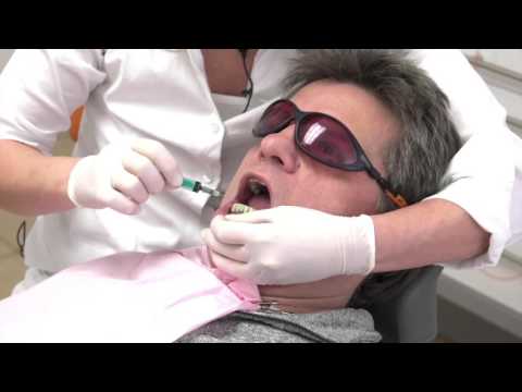 Video: Periodontal Behandling: Omkostninger, Laser, Faser, Indstillinger Og Mere