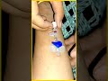 IV cannulation #reels #usa #youtubeshorts #trending #viral #ivcannula #medicaleducation #nursing