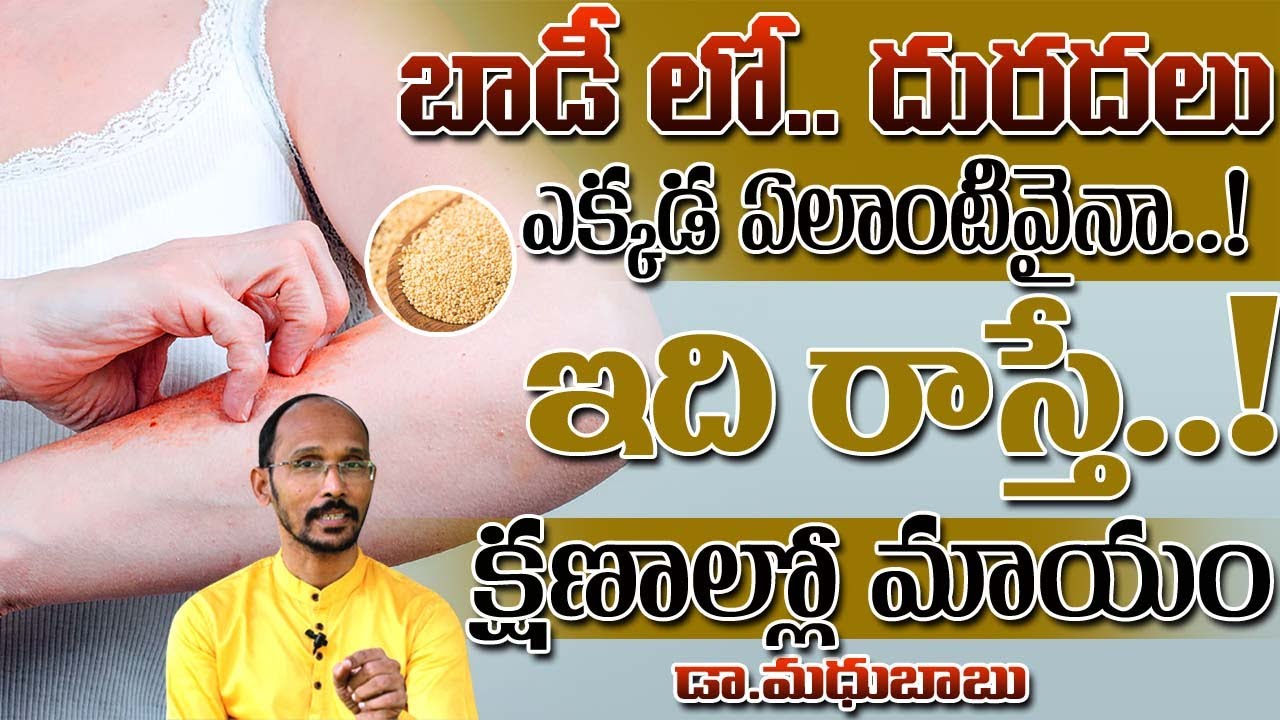 బాడీ లో దురదలు ఎక్కడ ఎలాంటివైనా  ఇది రాస్తే క్షణాల్లో మాయం ! | Dr. MadhuBabu | Health Trends |