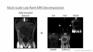 Compressed Sensing MRI with Multiscale Low Rank