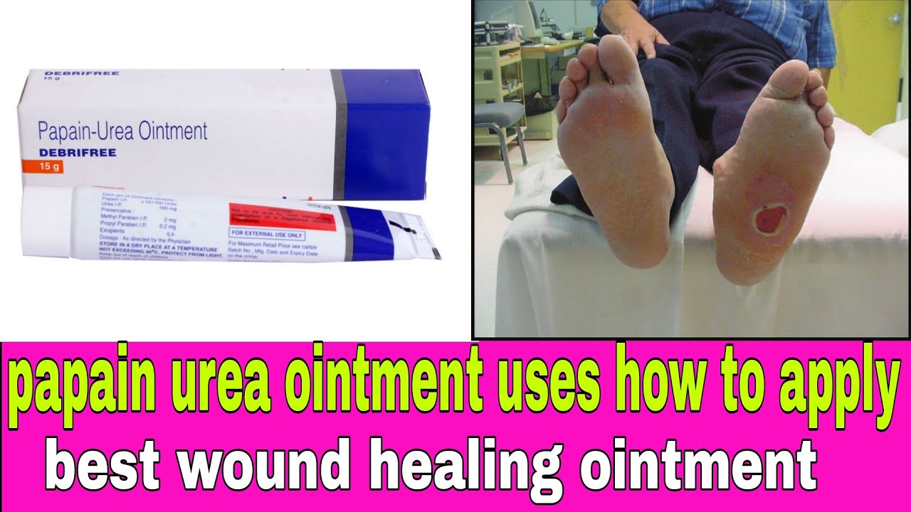 papain urea ointment uses in hindi | best wound healing ointment ...