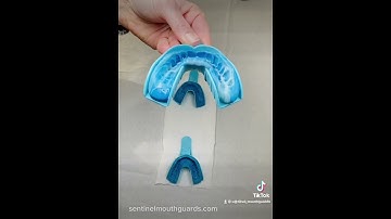 Example of a Great Dental Impression + Common Mistakes | @Sentinelmouthguards