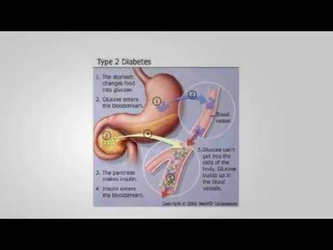 what-foods-should-diabetics-avoid-diabetic-grocery-list