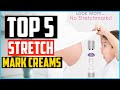 Top 5 Best Stretch Mark Creams In 2024 Reviews
