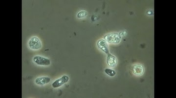 MICROBE IDENTIFICATION SAMPLE CLIP