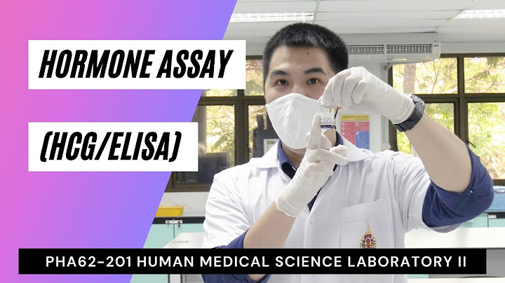 Elisa test ว เคราะห แนวโน ม central lab