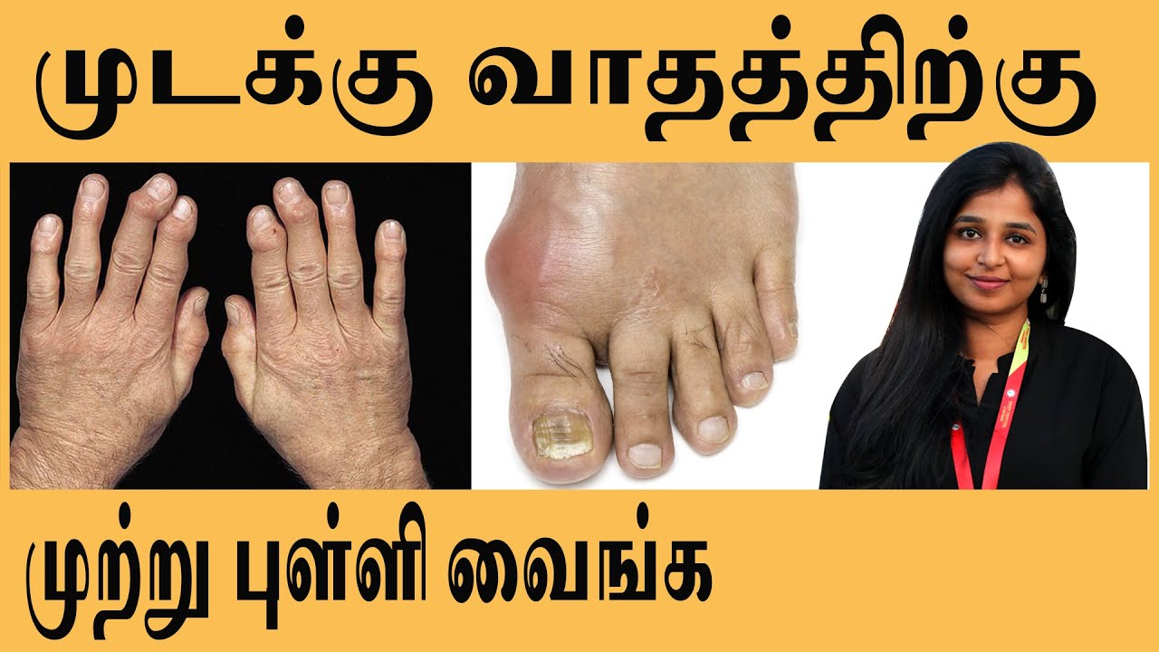 நகம் வலி வர காரணம் என்ன? | nail pain relief home remedy in tamil | nagam  vali | nail pain in tamil - YouTube