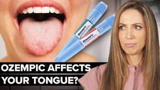 Ozempic Tongue: Real Or Hype? (dental Hygienist Explains)