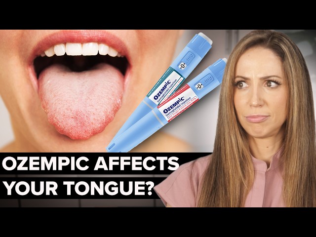 glp 1 tongue side effects Ozempic Tongue: Real or Hype? (Dental Hygienist Explains)