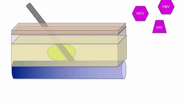 Opioid withdrawal and detoxification