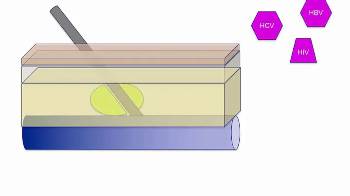 Opioid withdrawal and detoxification
