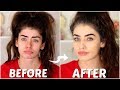 How To Cover Acne &amp; Blemishes (NON CAKEY &amp; EASY) | Jessie B