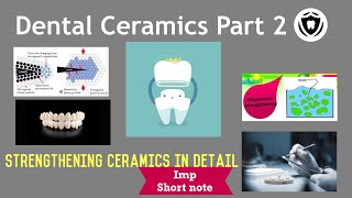 Dental Ceramics : Part 2