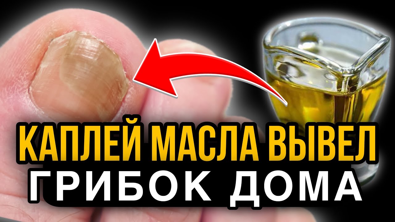 ВРАЧ: капнул и вытираешь вместе с ГРИБКОМ, а ЕСЛИ масло смешать с ...