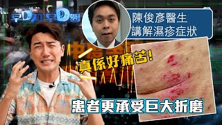 早D知早D醫濕疹治療中醫西醫有路數健康情報醫學知識醫學節目洪永城 宋宛穎 何沛珈 魏韵芝TVB綜藝