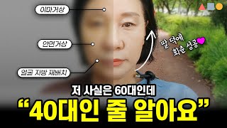 60대 안면거상 6개월차 후기 ❣ 딸 덕에 회춘 성공!